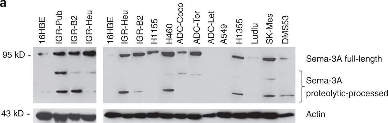 Western Blot Semaphorin 3A Antibody (215803) [Unconjugated]