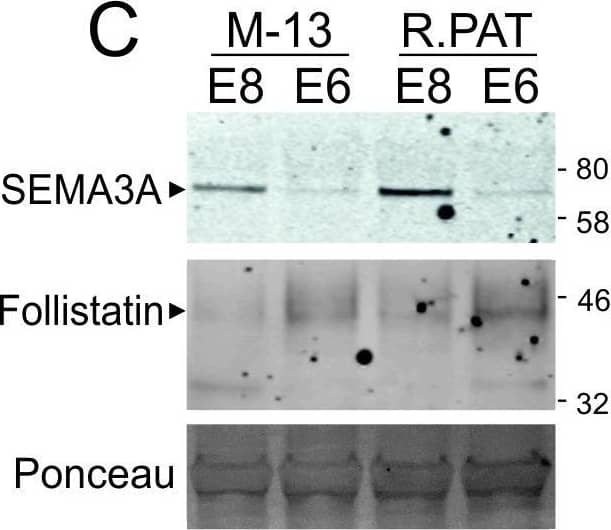 Western Blot Semaphorin 3A Antibody (215803) [Unconjugated]