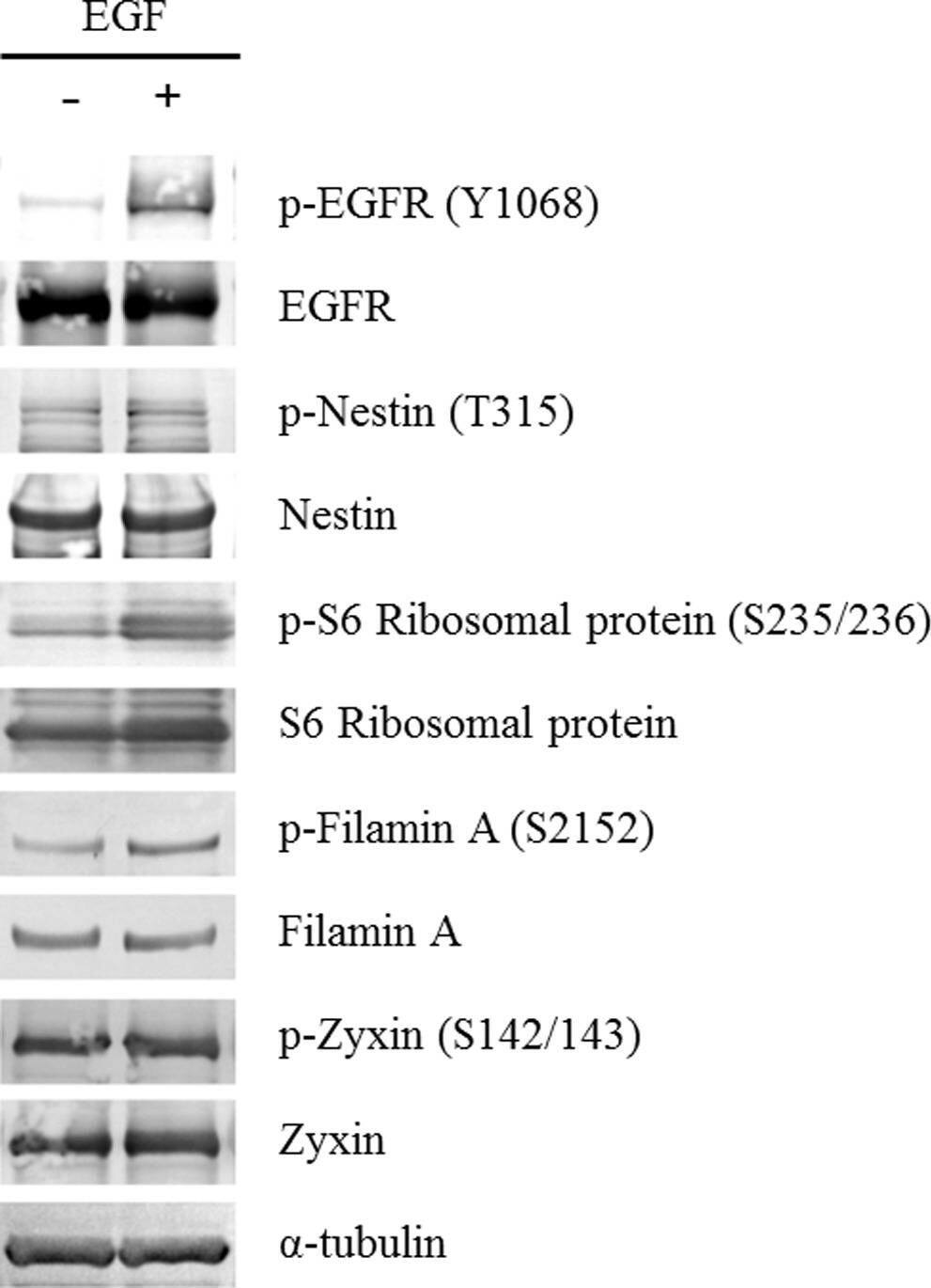 Validation of the phosphorylation status regarding the representative phosphoproteins by western blot analyses.Glioblastoma initiating cells were treated with 20 ng/ml EGF for 15 min and subjected to immunoblotting with the corresponding antibodies. Image collected and cropped by CiteAb from the following open publication (//pubmed.ncbi.nlm.nih.gov/22912867), licensed under a CC-BY license. Not internally tested by R&D Systems.