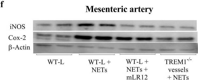 Western Blot TREM1 Antibody (193015) [Unconjugated]