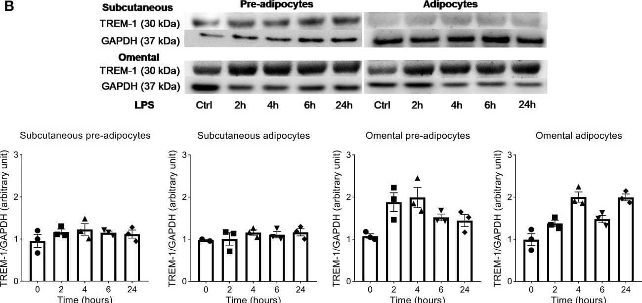 Western Blot TREM1 Antibody (193015) [Unconjugated]