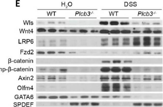 Small intestinal epithelial cells of Plcb3−/− mice exhibit downregulation of the Wnt/ beta -catenin signaling pathway. (A) GSEA indicates that the gene expression pattern in isolated IECs from Plcb3−/− mice correlates with the reduced expression of Wnt/ beta -catenin signature genes (upper left), Lgr4 regulated signature genes (lower left), Lgr4/Lgr5 regulated signature genes (upper right), and Ascl2 signature genes (lower right). NES: normalized enrichment score. n = 3 biological replicates. (B) qRT-PCR analysis of isolated IECs from WT and Plcb3−/− mice exposed to sterilized water or 3% DSS for 2 days. Normalized against Hprt mRNA. * p < 0.05; ** p < 0.01; *** p < 0.001; **** p < 0.0001, determined by two-tailed Student’s t-test. (C) GSEA with isolated IECs from Plcb3 ∆IEC mice indicated the reduced expression of Wnt/ beta -catenin (upper left), Lgr4 (lower left), Lgr4/Lgr5 (upper right), and Ascl2 (lower right) signature genes at the homeostatic condition. (D) Small intestines of WT and Plcb3−/− mice exposed to sterilized water or 3% DSS for 2 days were separated into mesenchymal tissues. RNAs isolated were subjected to qRT-PCR analysis. mRNA amounts for several Wnt ligands and Wnt secretion enablers (Wls and Porcn) were normalized against Hprt. * p < 0.05; ** p < 0.01, determined by Student’s t-test. (E) Western blot analysis of Wnt/ beta -catenin signaling proteins from WT and Plcb3−/− mice (3 mice each) under H2O and 2-day DSS treatments. Image collected and cropped by CiteAb from the following open publication (//pubmed.ncbi.nlm.nih.gov/38891118), licensed under a CC-BY license. Not internally tested by R&D Systems.