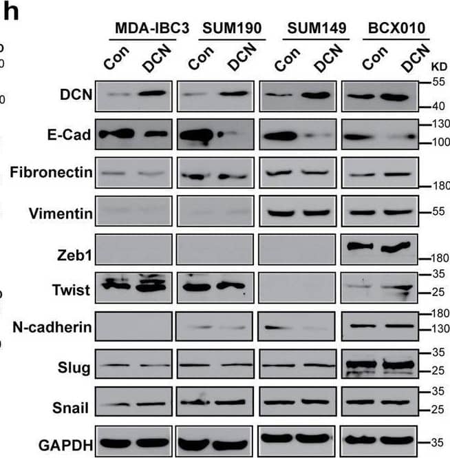 DCN inhibits E-cadherin expression and EGFR pathway activation in IBC.a DCN suppresses E-cadherin expression and EGFR signaling in IBC cells. Expression levels of E-cadherin and EGFR are decreased in DCN-overexpressing MDA-IBC3, SUM190, SUM149, and BCX010 cells; also, the phosphorylation of EGFR (pEGFR) and ERK1/2 (pERK1/2) was suppressed in DCN-overexpressing IBC cell lines. Total ERK1/2 (tERK1/2) remains unchanged. GAPDH served as a loading control. b Treatment of IBC cells with DCN protein (4 or 8 μg/mL) for 2 h suppresses E-cadherin expression and EGFR pathway activation. Tubulin served as a loading control. c and d Western blot validation of E-cadherin and EGFR downregulation in tumor samples obtained from mammary fatpad transplantation of control or DCN-overexpressing MDA-IBC3 (c) or SUM149 (d) cells. e and f Immunohistochemical staining validation of E-cadherin and EGFR downregulation in tumor samples obtained from mammary fatpad transplantation of control or DCN-overexpressing MDA-IBC3 (e) or SUM149 (f) cells. Scale bar: 100 μm. g DCN inhibits EGFR signaling in IBC cells independently of EGF stimulation. DCN-overexpressing and control IBC cell lines were stimulated with 50 ng/mL EGF for the indicated number of hours, and total cell lysates were analyzed by western blotting. Both the total levels and the phosphorylation levels of EGFR and ERK1/2 were detected by western blotting. Tubulin served as a loading control. h DCN-mediated inhibition of E-cadherin does not affect expression of epithelial–mesenchymal transition markers. Cell lysates containing 40 μg of total protein were analyzed by western blotting with anti-E-cadherin, fibronectin, vimentin, and DCN antibodies. GAPDH served as a loading control. Image collected and cropped by CiteAb from the following open publication (//pubmed.ncbi.nlm.nih.gov/33452400), licensed under a CC-BY license. Not internally tested by R&D Systems.