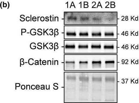 Response of serum sclerostin and Wnt/ beta ‐catenin signaling within scWAT to 4 weeks of SIT. (a) Serum sclerostin response to SIT. (b) Representative immunoblots of sclerostin, phosphorylated and total GSK3 beta ,  beta ‐catenin, and total protein loading control (Ponceau S) at pre‐SIT (labeled “a”) and post‐SIT (labeled “b”) with estimated molecular weights on the right. These representative samples are the same two participants (“1” and “2”) in sequence across proteins that highlight their response from pre‐ to post‐SIT. scWAT (c) sclerostin content, (d) total and phosphorylated GSK3 beta , and (e) total  beta ‐catenin response to SIT relative to pre‐SIT. Bar charts have black lines that represent individual responses to SIT with group means presented as white (pre‐SIT) and gray (post‐SIT) bars ± SD. Paired t‐tests were used to examine changes pre‐ to post‐SIT Image collected and cropped by CiteAb from the following open publication (//pubmed.ncbi.nlm.nih.gov/35312183), licensed under a CC-BY license. Not internally tested by R&D Systems.