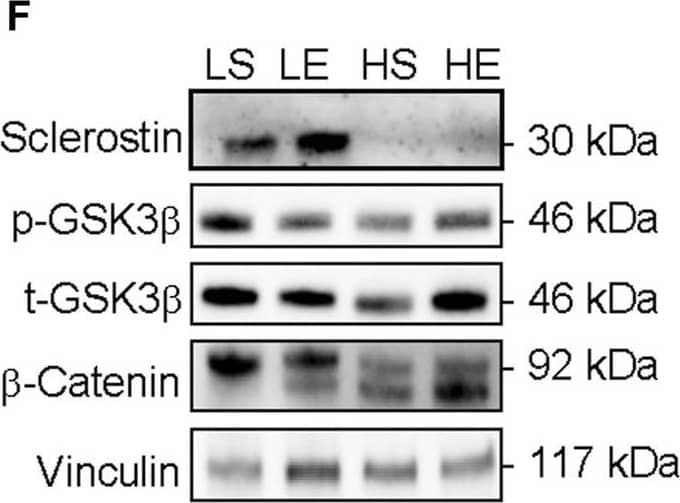 Response of eWAT sclerostin content (A), serine9 phosphorylation status (B,D) both total GSK3b content (C), and total b-catenin content (E) to HFD and acute exercise, as well as representative immunoblots (F). Light grey bars represent sedentary mice and dark grey bars represent mice sampled 2 h following 2 h of acute endurance exercise and are grouped by diet; LFD = low fat diet; HFD = high fat diet. Proteins are corrected for by the house keeping protein vinculin and are all relative to LFD sedentary mice, data are presented as means ± SD and main effects are presented on graphs only if they are either close to or are significant. A two-way factorial ANOVA was used to examine main effects for diet and exercise as well their interaction. Tukey correction was used for multiple pairwise comparisons. Image collected and cropped by CiteAb from the following open publication (//pubmed.ncbi.nlm.nih.gov/36685192), licensed under a CC-BY license. Not internally tested by R&D Systems.