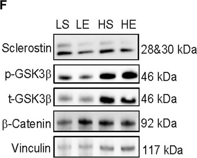 Response of iWAT sclerostin content (A), serine9 phosphorylation status (B,D) both total GSK3b content (C), and total b-catenin content (E) to HFD and acute exercise, as well as representative immunoblots (F). Light grey bars represent sedentary mice and dark grey bars represent mice sampled 2 h following 2 h of acute endurance exercise and are grouped by diet; LFD = low fat diet; HFD = high fat diet. Proteins are corrected for by the house keeping protein vinculin and are all relative to LFD sedentary mice, data are presented as means ± SD and main effects are presented on graphs only if they are either close to or are significant. A two-way factorial ANOVA was used to examine main effects for diet and exercise as well their interaction. Tukey correction was used for multiple pairwise comparisons. Image collected and cropped by CiteAb from the following open publication (//pubmed.ncbi.nlm.nih.gov/36685192), licensed under a CC-BY license. Not internally tested by R&D Systems.