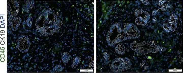 Deletion of Arginase 1 (Arg1) in myeloid cells decreases cell proliferation and cell death during early stages of pancreatic ductal adenocarcinoma.(A) Experimental design for KF and KFCA mice aged to 2 mo. (B) Representative images of co-immunofluorescence staining for ARG1 (red), macrophages (F4/80, green), epithelial (CK19, gray), and DAPI (blue) in KF and KFCA pancreata at 2 mo. Yellow staining shows co-localization of ARG1 and F4/80. Scale bar, 50 μm. Quantification on the right, n=4–6/group (C) Representative hematoxylin and eosin (H&E) images for KF and KFCA mice at 2 mo, n=6–7/group. Scale bar, 100 μm. On the right, percentage of ADM/PanIN lesions area in KF and KFCA tissue at 2 mo, n=6–7/group. (D) Representative immunohistochemistry staining for total cell proliferation (Ki67) and total cell death (cleaved caspase-3 [CC3]). Scale bar, 100 μm. Quantification on the right, n=6–7/group. (E) Representative immunofluorescence staining for immune cells (CD45, green) and epithelial cells (CK19, gray). Scale bar, 50 μm. Quantification on the right, n=4/group. (F) Representative immunohistochemistry staining for macrophages (F4/80) and CD8+ T cells (CD8) in KF and KFCA tissue at 2 mo. Scale bar, 100 μm. Positive staining quantification is shown on the right. Student’s t test was used to determine significance. Statistically significant when p<0.005. Image collected and cropped by CiteAb from the following open publication (//pubmed.ncbi.nlm.nih.gov/36727849), licensed under a CC-BY license. Not internally tested by R&D Systems.