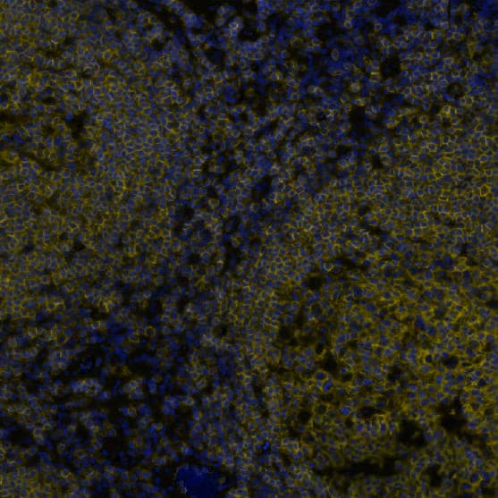CD45 was detected in immersion fixed paraffin-embedded sections of human lymph node using Mouse Anti-Human CD45 Monoclonal Antibody (MAB14303) at 5µg/mL at 37 ° Celsius for 4 minutes. Before incubation with the primary antibody, tissue underwent an all-in-one dewaxing and antigen retrieval preprocessing using PreTreatment Module (PT Module) and Dewax and HIER Buffer H (pH 9). Tissue was stained using the Alexa Fluor™ 555 Goat anti-Mouse IgG Secondary Antibody at 1:100 at 37 ° Celsius for 2 minutes. (Yellow; Lunaphore Catalog # DR555MS) and counterstained with DAPI (blue; Lunaphore Catalog # DR100). Specific staining was localized to the membrane. Protocol available in COMET™ Panel Builder.