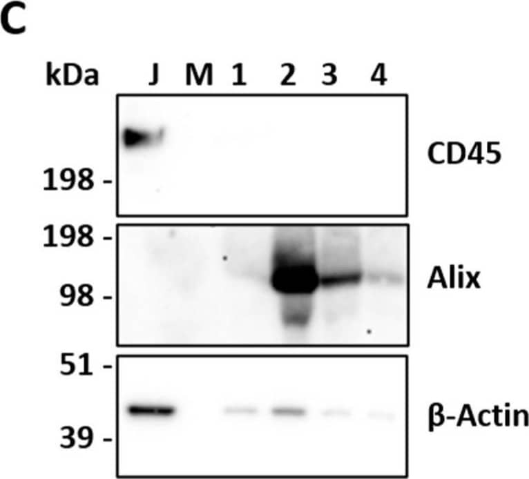 EV characterization. (A) Nanotracking analysis of PCa and BPH samples showing EV size and concentration. (B) Representative images of sEV acquisitions by SEM at different magnifications. (C) Western Blot analysis on Jurkat (J) and vesicular lysates (1, 2, 3, and 4) to detect CD45, Alix, and  beta -actin. Abbreviations: PCa: prostate cancer; BPH: benign prostate hyperplasia; sEVs: small extracellular vesicles; SEM: scanning electron microscopy; J: Jurkat cell lysate; M: marker. Image collected and cropped by CiteAb from the following open publication (//pubmed.ncbi.nlm.nih.gov/39120316), licensed under a CC-BY license. Not internally tested by R&D Systems.