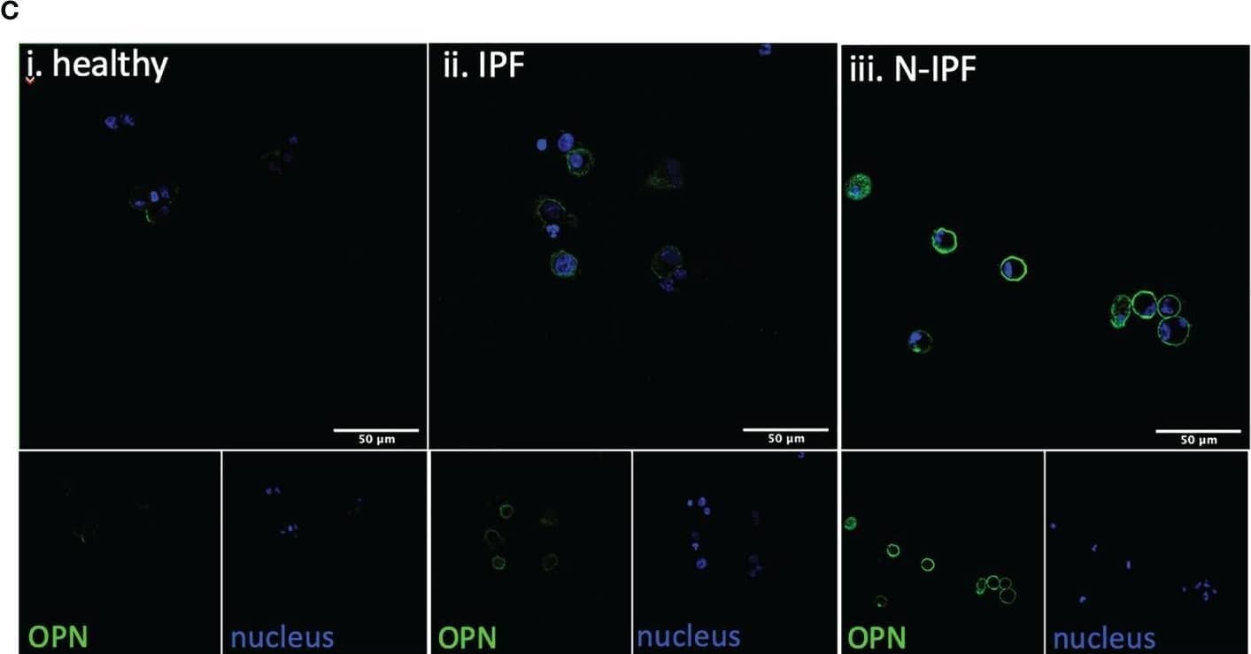 SPP1 and OPN expression in BAL cells. (A) SSP1 relative mRNA levels in IPF and N-IPF relative to healthy (Brown-Forsythe Anova, with individual comparisons), (B) Violin plots of mean OPN expression/cell per disease group (Kruskal-Wallis test and individual comparisons) and (C) Typical Images of BAL cytospins stained with anti-human OPN antibody and ToPro-633 nuclear stain in (i) healthy, (ii) IPF and (iii) N-IPF samples (*p < 0.05, **P < 0.01, ****p < 0.0001). Image collected and cropped by CiteAb from the following open publication (//pubmed.ncbi.nlm.nih.gov/34867934), licensed under a CC-BY license. Not internally tested by R&D Systems.