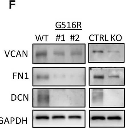 Secretome analysis of WT, COG4p.G516R, and COG4-KO chondrosarcoma cells. (A) Coomassie blue staining of proteins in cell lysates and conditioned medium from COG4p.G516R clones #1, #2, WT controls and COG4 KO cells. (B) Volcano plot of differentially secreted proteins between COG4p.G516R and WT. (C) Volcano plot of differentially secreted proteins between COG4p.G516R and COG4-KO cells. A few top candidates confirmed by pathway analysis were labeled respectively. (D) Dot plot showing enriched pathways from Gene Set Enrichment Analysis with the Normalized Enrichment Score (NES) shown on the X-axis. The size of the dots represents the number of genes in the significant Data Set list associated with the GO term and the color of the dots represent the adjusted p- values. (E) Table showing a list of top 10 candidates which were decreased in secretions of COG4p.G516R with log 2 (Fold Change) and adjusted p-value shown for COG4p.G516R vs. WT and COG4p.G516R vs. COG4-KO. The number of peptides is equal to or more than two for all the candidates shown in table. (F) Western blotting of top candidates in medium decreased in both COG4p.G516R and COG4-KO cells compared to WT. GAPDH was from cell lysates with comparable amount as loading control. (G) Western blotting of top candidates only changed in COG4p.G516R compared to WT and COG4-KO cells. All experiments were performed in duplicate with similar results. Image collected and cropped by CiteAb from the following open publication (//pubmed.ncbi.nlm.nih.gov/36393834), licensed under a CC-BY license. Not internally tested by R&D Systems.