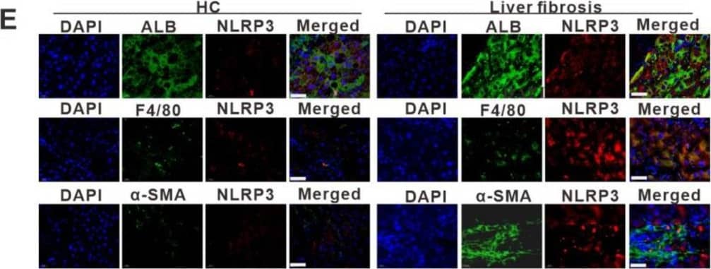 NLRP3 inflammasome-dependent pyroptosis occurs in liver fibrosis. (A) IHC staining for GSDMD, IL-1 beta , and IL-18 in liver sections from liver fibrosis patients and HCs. Scale bar: 40 µm. (B–D) ELISA analyses of serum levels of GSDMD (B), IL-1 beta  (C), and IL-18 (D) in liver fibrosis patients (n = 89) and HCs (n = 60). (E) Representative immunofluorescence images of NLRP3 (red) and albumin (hepatocyte marker) (top), F4/80 (KC marker) (middle) or  alpha -SMA (HSC marker) (bottom) (green) from the human fibrotic liver tissues. Scale bar: 40 µm. (F) Schematic diagram of the study. Liver fibrosis was induced by CCl4 injection for 8 weeks. (G) Representative mouse liver histology of H&E, Sirius Red staining, and IHC staining for  alpha -SMA, GSDMD, and IL-1 beta . Black scale bar: 100 µm; Red scale bar: 50 µm. (H–J) ELISA analyses for serum levels of GSDMD (H), IL-1 beta  (I), and IL-18 (J) in CCl4 group mouse (n = 5) and vehicle group mouse (n = 5). (K) Representative immunofluorescence images of NLRP3 (red) and albumin (hepatocyte marker) (top), F4/80 (KC marker) (middle) or  alpha -SMA (HSC marker) (bottom) (green) from the 8-week CCl4-treated mouse liver. The vehicle group mouse liver was used as a control. Scale bar: 40 µm. (L) The qRT-PCR analysis for mRNA levels of IL-1 beta  in THP-1 macrophages treated with LPS to induce pyroptosis. (M) ELISA analysis for IL-1 beta  expression in supernatants from THP-1. (N) Western blot analysis of COL1A1,  alpha -SMA, and TGF-beta  expression in LX-2 cells which were exposed to CM from LPS-treated THP-1 macrophages. The protein expression was quantified by densitometry and normalized to  beta -actin and are shown as fold changes relative to the control group (right panel). ** p < 0.01, *** p < 0.001. Image collected and cropped by CiteAb from the following open publication (//pubmed.ncbi.nlm.nih.gov/36429008), licensed under a CC-BY license. Not internally tested by R&D Systems.