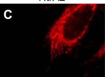 HtrA2/Omi expression increases following CMV infection.(A–B) Immunoblot analyses of HtrA2/Omi in lysates of mock-infected HF (M) or HF infected (MOI of 3) with Towne-BAC or  delta UL37x1 for 24, 48, 72, 96, or 120 h and control cell lysates from HeLa cells transfected with HtrA2/Omi expression plasmid (+) or control plasmid (−). The expected migration of the 49 kDa immature, pro-HtrA2/Omi and 36 kDA mature, HtrA2/Omi was calculated based on migration of molecular weight markers (not shown). Immunoblot detection of HtrA2,  beta -actin and IE1 are shown. (C–N) Immunofluorescent images of HtrA2/Omi (C, F) and cytochrome c (I, L) (red), and GFP fluorescence (green) (D, G, J, M) and merged images (E, H, K, N) at 72 h (C–H) or 96 h (I–N) postinfection (MOI of 0.001) with  delta UL37x1 (C–E, I–K) or Towne-BAC (F–H, L–N). Original magnification ×1000. Image collected and cropped by CiteAb from the following open publication (//pubmed.ncbi.nlm.nih.gov/18769594), licensed under a CC-BY license. Not internally tested by R&D Systems.