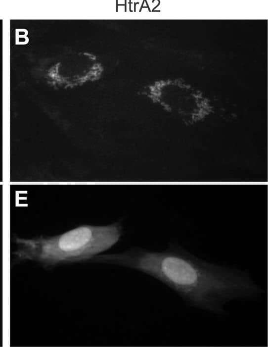 Transient overexpression of HtrA2/Omi induces early death in CMV-infected but not uninfected cells.(A–F) Immunofluorescent images of HtrA2/Omi (A–C) and GFP fluorescence (D–F) following cotransfection of HF with GFP expression plasmid together with empty vector, HtrA2/Omi, or HtrA2S306A expression plasmids. Original magnification ×400. (G) Immunoblot depicting 49 kDa, immature and 36 kDA, mature forms of HtrA2/Omi and HtrA2S306A as well as  beta -actin control in transfected HeLa cell lysates. (H) Percentage of live HFs at 120 h post cotransfection of GFP expression plasmid with vector, HtrA2/Omi, or HtrA2S306A expression plasmids. (I) Number of viral plaques 10 days following cotransfection of  delta UL37x1 or Towne-BAC DNA (500 ng) with 800 ng vector, HtrA2/Omi, or HtrA2S306A expression plasmids. (J) Number of live (intact) cells in cultures at 48 or 72 h following transfection with Towne-BAC DNA (300 ng) alone or with 333 ng of HtrA2 or HtrA2S306A expression plasmids. (K) Number of live (intact) cells (±range) at 48 or 72 h post transfection with Towne-BAC DNA (500 ng) and 300 ng of vector or HtrA2/Omi expression plasmid with or without addition of 10 µM UCF-101 from 6 h. Image collected and cropped by CiteAb from the following open publication (//pubmed.ncbi.nlm.nih.gov/18769594), licensed under a CC-BY license. Not internally tested by R&D Systems.