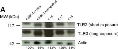 TLR3 is highly expressed in NPC cell lines and xenografts. Western blot analysis reveals intense expression of TLR3 in EBV-positive C666-1, C18, C17 and C15 xenografts/cell lines (A), and in EBV-negative HONE1 and CNE1 NPC cell lines (B). To better characterize the status of TLR3 in NPC cells, its expression was simultaneously assessed in C666-1, in the non NPC head and neck squamous cell carcinoma cell lines SQ20B and FaDu, and in a panel of non malignant and malignant epithelial cell-lines, namely NP69 and NP460 (non tumorigenic immortalized nasopharyngeal cell lines), HeLa, C33 and CaSki (cervical carcinoma), SW613 (colon carcinoma), A549 (non-small cell lung cancer), and A431 (vulvar squamous carcinoma) (C). The same blotted membranes were stained with anti-actin for protein loading controls. Image collected and cropped by CiteAb from the following open publication (//pubmed.ncbi.nlm.nih.gov/23198710), licensed under a CC-BY license. Not internally tested by R&D Systems.