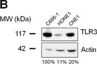 TLR3 is highly expressed in NPC cell lines and xenografts. Western blot analysis reveals intense expression of TLR3 in EBV-positive C666-1, C18, C17 and C15 xenografts/cell lines (A), and in EBV-negative HONE1 and CNE1 NPC cell lines (B). To better characterize the status of TLR3 in NPC cells, its expression was simultaneously assessed in C666-1, in the non NPC head and neck squamous cell carcinoma cell lines SQ20B and FaDu, and in a panel of non malignant and malignant epithelial cell-lines, namely NP69 and NP460 (non tumorigenic immortalized nasopharyngeal cell lines), HeLa, C33 and CaSki (cervical carcinoma), SW613 (colon carcinoma), A549 (non-small cell lung cancer), and A431 (vulvar squamous carcinoma) (C). The same blotted membranes were stained with anti-actin for protein loading controls. Image collected and cropped by CiteAb from the following open publication (//pubmed.ncbi.nlm.nih.gov/23198710), licensed under a CC-BY license. Not internally tested by R&D Systems.