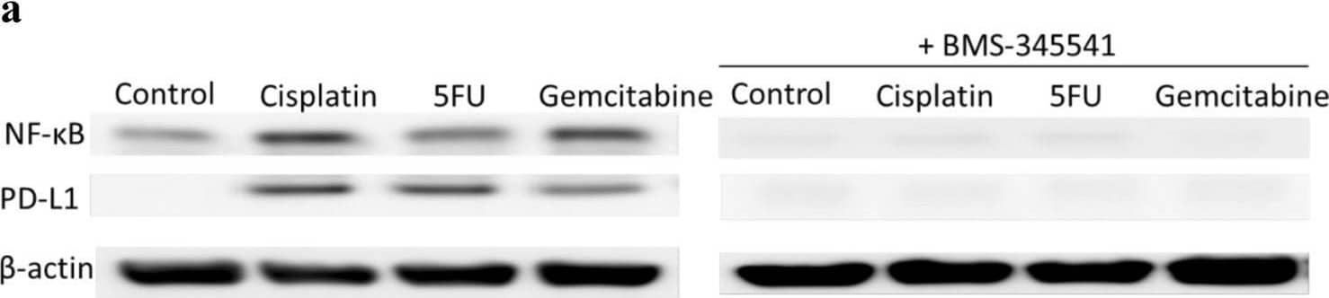 Chemotherapeutics induce PD-L1 expression in NPC cells and PD-1 expression in NK cells via upregulation of NF-kappa B. NPC cells a or NK cells c were incubated with the NF-kappa B inhibitor BMS-345541 for 1 h before incubation with chemotherapeutics. NPC cells were transfected with NF-kappa B siRNA b or NK cells with NF-kappa B siRNA d for 16 h and then incubated with chemotherapeutics. Expression of NF-kappa B, PD-L1 and PD-1 was analyzed by immunoblot Image collected and cropped by CiteAb from the following open publication (//pubmed.ncbi.nlm.nih.gov/32737537), licensed under a CC-BY license. Not internally tested by R&D Systems.