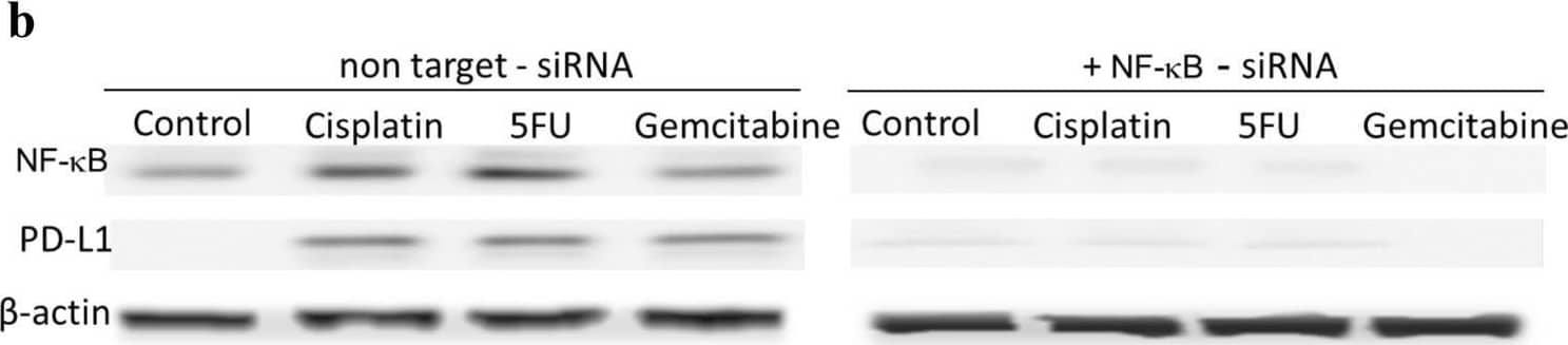 Chemotherapeutics induce PD-L1 expression in NPC cells and PD-1 expression in NK cells via upregulation of NF-kappa B. NPC cells a or NK cells c were incubated with the NF-kappa B inhibitor BMS-345541 for 1 h before incubation with chemotherapeutics. NPC cells were transfected with NF-kappa B siRNA b or NK cells with NF-kappa B siRNA d for 16 h and then incubated with chemotherapeutics. Expression of NF-kappa B, PD-L1 and PD-1 was analyzed by immunoblot Image collected and cropped by CiteAb from the following open publication (//pubmed.ncbi.nlm.nih.gov/32737537), licensed under a CC-BY license. Not internally tested by R&D Systems.