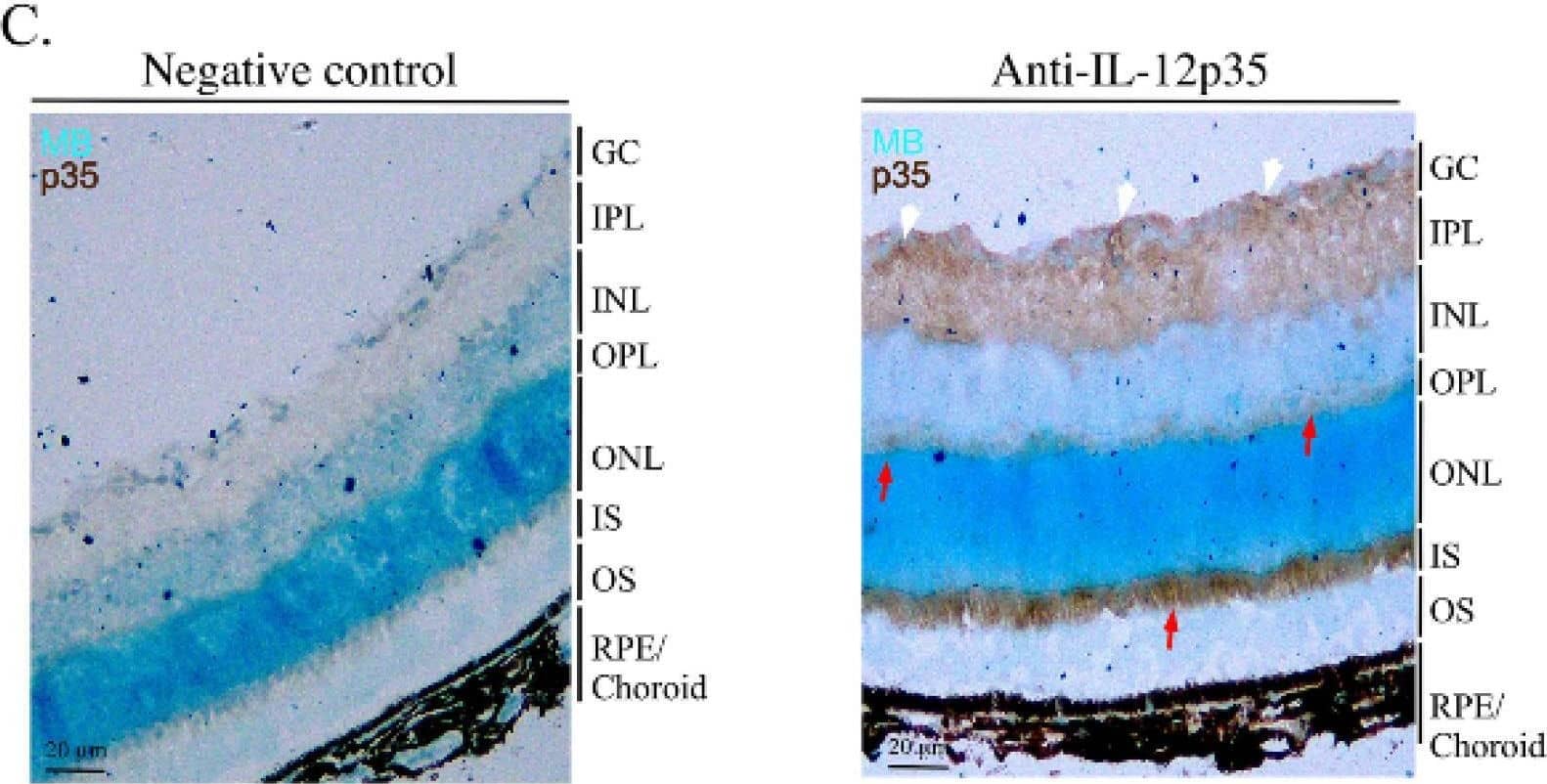 IL-35 is highly expressed in retinal rod and cone photoreceptors. (A) qPCR analysis of p35, ebi3 IL-10 mRNA transcripts in the retina and spleen of WT mice. (B) Western blot analysis of whole cell extracts prepared from sorted CD4+ T cells, CD19+ B cells, dendritic cells (CD11c) and monocytes (Ly6C). Antibodies used were specific to mouse p35 or  beta -actin. (C) Immunohistochemistry (IHC) analyses of frozen eye sections were performed with or without primary mouse IL-12p35 antibodies and goat anti-mouse (fab’2) secondary antibody. Slides were then stained with a DAB kit and counter-stained with methyl blue. IL-12p35-expressing cells, dark brown; microglia, white arrows; photoreceptor layers, red arrows. (D,E) Detection of IL-12p35-expressing cells by immunohistochemistry and confocal microscopy. Paraffin-fixed whole eye sections were subjected to antigen-retrieval, blocked in mouse blocking solution, incubated without or with primary rabbit IL-12p35 antibody and then goat anti-rabbit conjugated with AF647 antibody. Far-red magenta color indicates IL-12p35 expression; red arrow, photoreceptor layers; white arrow, microglial cells. GC, ganglion cell layer; IPL, inner plexiform layer; INL, inner nuclear layer; OPL outer plexiform layer, ONL, outer nuclear layer; IS, inner section; OS, outer segment; RPE/choroid, retinal pigmented epithelial and choroid. Data represent at least 3 independent experiments. *** p < 0.001. Image collected and cropped by CiteAb from the following open publication (//pubmed.ncbi.nlm.nih.gov/35897732), licensed under a CC-BY license. Not internally tested by R&D Systems.