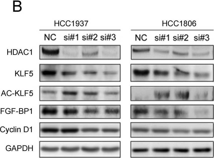  Both HDACi and HDAC1 knockdown downregulated the expression of KLF5 protein and its downstream targets genes. A, HDACi inhibited KLF5-mediated downstream target gene (FGF-BP1, Cyclin D1, and p21 expression changes. HCC1937 and HCC1806 cells were treated with HDACi for 48 h at the indicated concentrations. The protein expression was measured by Western blotting. B, HDAC1 knockdown by three different siRNAs in HCC1937 and HCC1806 cells for 48 h; cell lysates were collected for western blotting, which indicated that KLF5 and its downstream target gene (FGF-BP1 and Cyclin D1) expression were blocked. C, HDAC1 knockdown-induced reduction in KLF5 expression in BLBC was inhibited by proteasome inhibitor. HDAC1 was knocked down by three different siRNAs in HCC1937 and HCC1806 cells for 24 h. Subsequently, MG132 (3 µM) was used to treat the cells for 24 h. Cell lysates were collected for Western blotting. Image collected and cropped by CiteAb from the following open publication (//pubmed.ncbi.nlm.nih.gov/35342356), licensed under a CC-BY license. Not internally tested by R&D Systems.