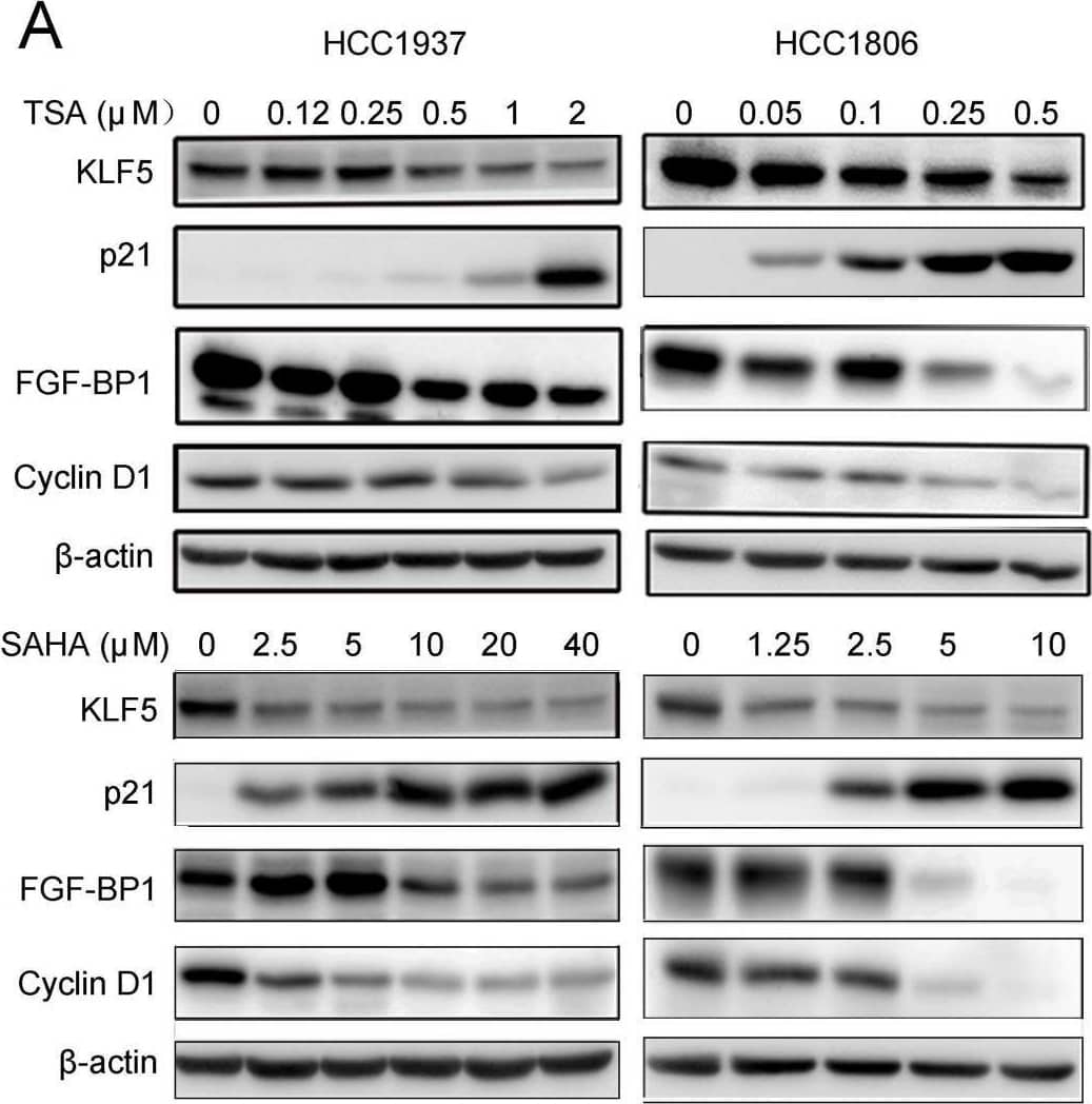  Both HDACi and HDAC1 knockdown downregulated the expression of KLF5 protein and its downstream targets genes. A, HDACi inhibited KLF5-mediated downstream target gene (FGF-BP1, Cyclin D1, and p21 expression changes. HCC1937 and HCC1806 cells were treated with HDACi for 48 h at the indicated concentrations. The protein expression was measured by Western blotting. B, HDAC1 knockdown by three different siRNAs in HCC1937 and HCC1806 cells for 48 h; cell lysates were collected for western blotting, which indicated that KLF5 and its downstream target gene (FGF-BP1 and Cyclin D1) expression were blocked. C, HDAC1 knockdown-induced reduction in KLF5 expression in BLBC was inhibited by proteasome inhibitor. HDAC1 was knocked down by three different siRNAs in HCC1937 and HCC1806 cells for 24 h. Subsequently, MG132 (3 µM) was used to treat the cells for 24 h. Cell lysates were collected for Western blotting. Image collected and cropped by CiteAb from the following open publication (//pubmed.ncbi.nlm.nih.gov/35342356), licensed under a CC-BY license. Not internally tested by R&D Systems.