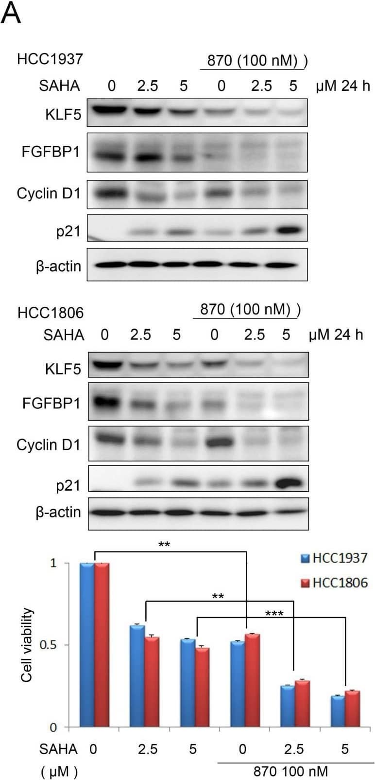  HDACi in combination with BRD4i inhibit the KLF5 expression and function and the survival of BLBC cells. A, HDACi were combined with compound 870 to regulate the expression of KLF5 and its downstream target genes (FGF-BP1, Cyclin D1, and p21). HCC1937 and HCC1806 cells were treated with HDACi and compound 870 for 24 h at the indicated concentrations. The protein expression was measured by Western blotting, and cell viability was assessed after 24 h by the SRB assay. B, KLF5 knockdown decreased the cytotoxicity of HDACi in BLBC cell lines. KLF5 was knocked down by two different siRNAs in HCC1937 and HCC1806 cells and cell lysates were collected for Western blotting. The cells were treated with HDACi for 48 h to measure cell viability by the SRB assay. Image collected and cropped by CiteAb from the following open publication (//pubmed.ncbi.nlm.nih.gov/35342356), licensed under a CC-BY license. Not internally tested by R&D Systems.