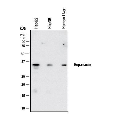 Western blot shows lysates of HepG2 human hepatocellular carcinoma cell line, Hep3B human hepatocellular carcinoma cell line, Human Liver. PVDF membrane was probed with 2 µg/mL of Mouse Anti-Human Hepassocin/FGL1 Monoclonal Antibody (Catalog # MAB16143) followed by HRP-conjugated Anti-Mouse IgG Secondary Antibody (Catalog # HAF018). A specific band was detected for Hepassocin/FGL1 at approximately 34 kDa (as indicated). This experiment was conducted under reducing conditions and using Western Blot Buffer Group 1.