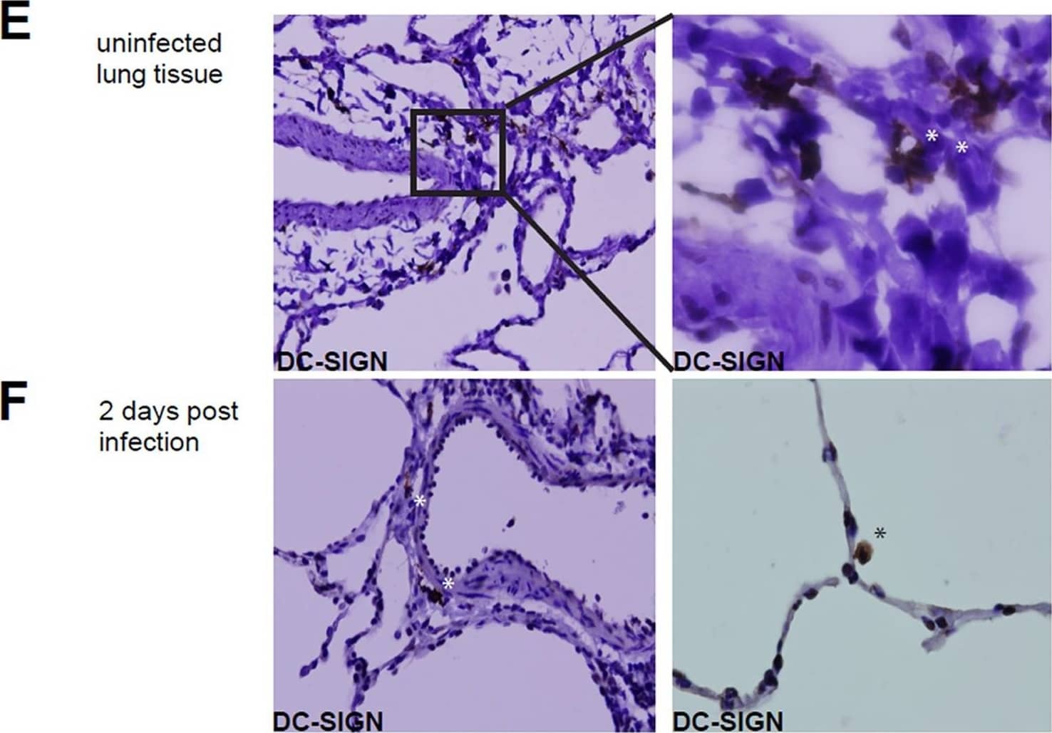 Infection of DC-SIGN+ cells in the lung.(A) Infection of the DC-SIGNhi, DC-SIGNlo and DC-SIGN- cells in BAL from MV-infected macaques, determined by detection of EGFP in flow cytometry at day 2–5 d.p.i. Each dot represents an individual animal. Lines indicate geometric means. (B) Macroscopic images from EGFP+ lung slices collected 3 d.p.i., cultured for additional 3,5,7 or 10 days. (C) Phenotype of cells migrating from the ex vivo cultured lung slice, collected from supernatant after 5 days of culturing (D) Phenotype of EGFP+ cells collected from lung slice medium. (E-F) DC-SIGN expression on lung sections from uninfected macaques (E) or 2.d.p.i. (F) Asterisks indicate DC-SIGN reactivity. Image collected and cropped by CiteAb from the following open publication (//pubmed.ncbi.nlm.nih.gov/23227146), licensed under a CC-BY license. Not internally tested by R&D Systems.