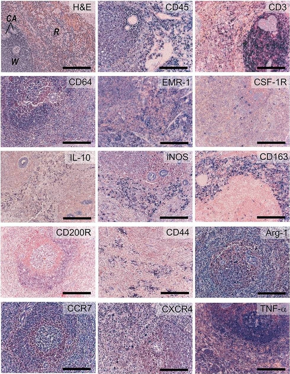 Inflammatory markers. Sections of activated ovine spleen, isolated from a sheep with endocarditis. Hematoxylin and eosin (H&E, top left) staining reveals the characteristic splenic red pulp (R) and white pulp (W), with the central arterioles (CA). Sections are stained with antibodies against CD45, CD3, CD64, EGF-like module-containing mucin-like hormone receptor-like 1 (EMR-1), colony stimulating factor-1 receptor (CSF-1R), interleukin-10 (IL-10), inducible nitric oxide synthase (iNOS), CD163, CD200R, CD44, Arginase-1 (Arg-1), CCR-7, CXCR4, and tumor necrosis factor-alpha  (TNF-alpha ). Scale bars, 200 μm. Image collected and cropped by CiteAb from the following open publication (//pubmed.ncbi.nlm.nih.gov/30159315), licensed under a CC-BY license. Not internally tested by R&D Systems.