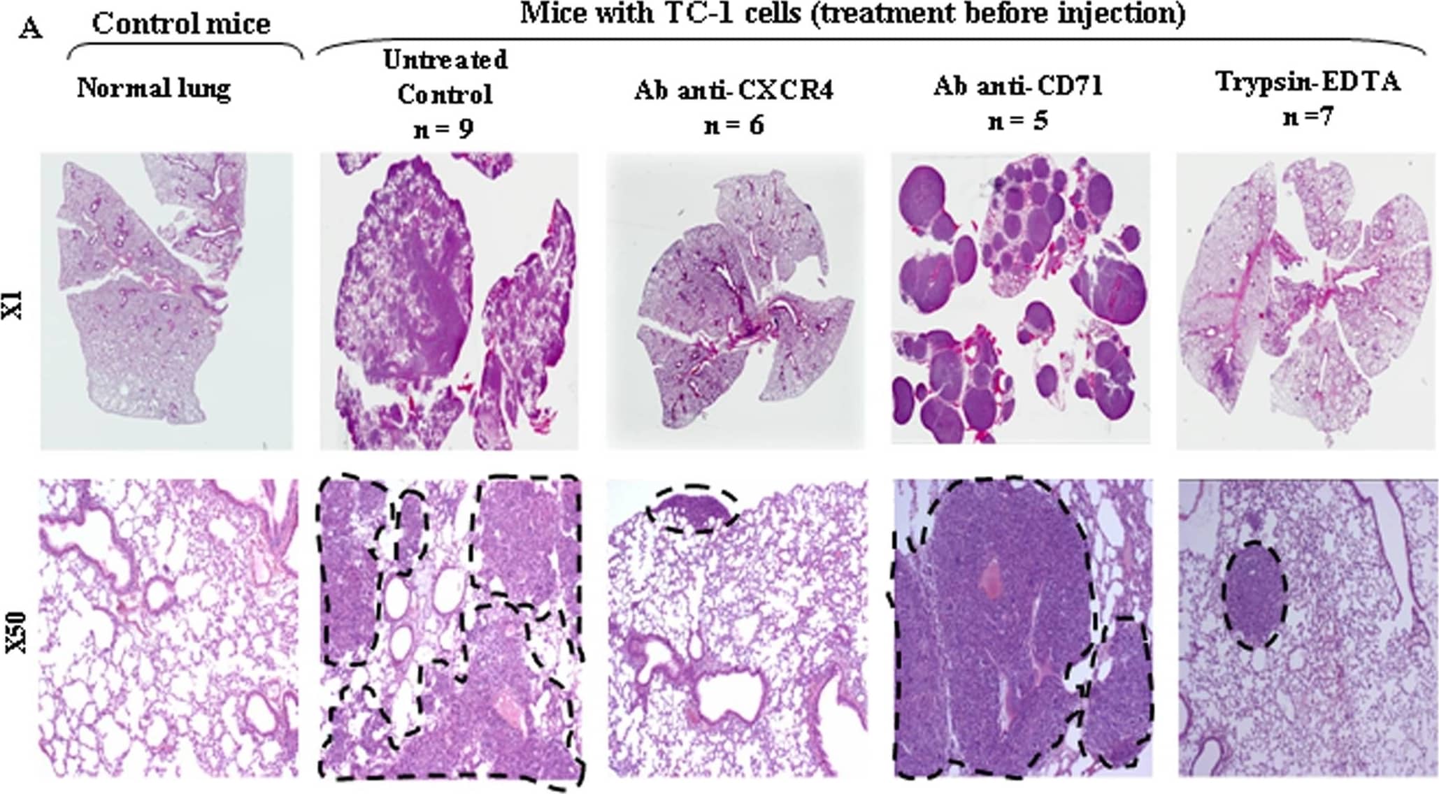 TC-1 cell lung metastasis is mediated by the CXCR4 in vivo.TC-1 cells (1×106) were injected into mice tail veins either without or with pre-treatment with CXCR4-blocking antibody (2B11), irrelevant antibody (CD71), or trypsin/EDTA. (A). Representative Hematoxylin-Eosin-Saffranin (HES)-satined sections of lungs of mice are shown. Digitization of the whole slides was performed for each animal/treatment type. Histopathological analysis was done after delineation of metastases (dashed line) vs whole lung area (B) on each HES-stained section with the ImageJ software. The lung metastasis indices within each cohort of mice are expressed as fold decrease (+/−SEM) over untreated controls ***P<0.01. (C) Representative sections of CXCR4 immunostaining are shown. Image collected and cropped by CiteAb from the following open publication (//pubmed.ncbi.nlm.nih.gov/19325708), licensed under a CC-BY license. Not internally tested by R&D Systems.