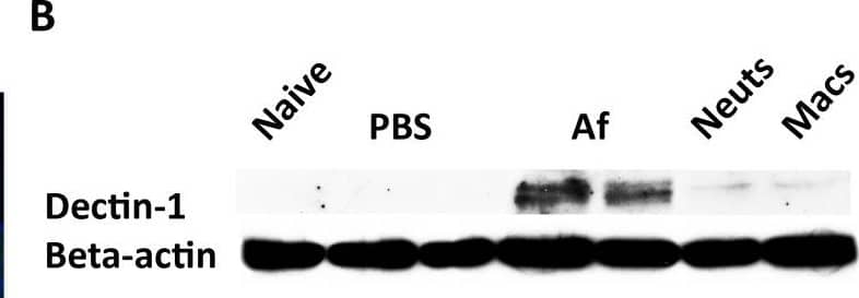  beta -glucan expression and Dectin-1 signaling in A. fumigatus keratitis. Fungal  beta -glucan expression and Dectin-1 protein activation in the cornea during Aspergillus infection were assessed by IHC and western blot analysis, respectively. A. 5µm central cornea sections at 6 and 24h post-infection were PASH stained to visualize swollen conidia (6h) and hyphae (24h), while  beta -glucan expression was detected using a mouse anti-fungal  beta -glucan antibody. B. Western blot analysis using anti-Dectin-1 antibody or C. anti-pSyk antibody was performed on cornea protein lysates from naïve, 10h PBS injected (trauma control), and 10hr A. fumigatus infected corneas. Data are representative of two independent experiments, with three corneas per time point. [Endo- endothelium Epi- epithelium, Neuts- casein-elicited peritoneal neutrophils. MACs- thioglycolate-elicited peritoneal, macrophages.] Image collected and cropped by CiteAb from the following open publication (//pubmed.ncbi.nlm.nih.gov/20617171), licensed under a CC-BY license. Not internally tested by R&D Systems.