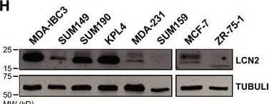 LCN2 was highly expressed in tumors from patients with IBC. (A) High LCN2 expression was associated with shorter overall survival in a meta‐dataset of patients with non‐IBC. (B, C) LCN2 mRNA expression was higher in tumors from IBC patients vs non‐IBC patients in two independent breast cancer datasets [IBC World Consortium Dataset; GSE45582]. (D) LCN2 mRNA expression was higher in ER‐negative compared to ER+ samples IBC samples. (E) LCN2 mRNA expression was higher in more aggressive molecular subtypes, ERBB2+ and TNBC, compared to HR‐positive/HERBB2‐negative subtype. (F) LCN2‐high expression correlates with shorter overall survival in patients with IBC. (G) LCN2 mRNA expression was higher in IBC cell lines compared to non‐IBC cell lines. (H, I) LCN2 protein expression was higher in IBC cell lines compared to non‐IBC cell lines shown by (H) immunoblotting or (I) ELISA for secreted LCN2 in supernatants. Bar graphs indicate mean ± SEM from three independent experiments. graphpad prism software was used to obtain the P values, with Mann–Whitney tests used to compare two categories or one‐way analysis of variance to compare three or more categories. Black lines in each group (B–E, and G) indicate mean ± SD. Image collected and cropped by CiteAb from the following open publication (//pubmed.ncbi.nlm.nih.gov/34342930), licensed under a CC-BY license. Not internally tested by R&D Systems.