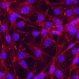 Integrin  beta 1/CD29 was detected in immersion fixed A549 human lung carcinoma cell line using Mouse Anti-Human/Porcine/Equine Integrin  beta 1/CD29 Monoclonal Antibody (Catalog # MAB17783) at 25 &micro;g/mL for 3 hours at room temperature. Cells were stained using the NorthernLights&trade; 557-conjugated Anti-Mouse IgG Secondary Antibody (red; Catalog # NL007) and counterstained with DAPI (blue). Specific staining was localized to plasma membrane.