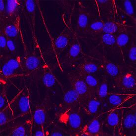 Integrin  beta 1/CD29 was detected in immersion fixed A549 human lung carcinoma cell line using Mouse Anti-Human Integrin  beta 1/CD29 Monoclonal Antibody (Catalog # MAB1778) at 8 &micro;g/mL for 3 hours at room temperature. Cells were stained using the NorthernLights&trade; 557-conjugated Anti-Mouse IgG Secondary Antibody (red; NL007) and counterstained with DAPI (blue). Specific staining was localized to plasma membrane.