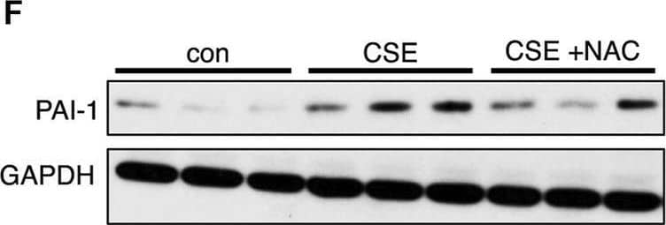 CSE decreases the fibrinolytic activity of LECs in vitro.(A) Immunocytochemical staining of cultured human microvascular lymphatic endothelial cells (LECs) for the human lymphatic markers, PROX1 and podoplanin (red). (B) Fibrin gel zymogram using supernatants from control or CSE-treated LECs. (C) Western blot for PAI-1 using cell lysates from control or CSE-treated LECs. GAPDH was used as a loading control on the same blot. (D,E) Expression of PAI-1 and t-PA by quantitative PCR using lysates from control or CSE-treated LECs and normalized to GAPDH. (F) Western blot using lysates from cells treated with CSE with and without co-incubation with N-acetylcysteine (NAC). GAPDH was used as a loading control on the same blot. Values are expressed as means ± SD. p-value calculated by Student’s t-test, **** p < 0.0001, ns = not significant. Data representative of two independent experiments performed in triplicate. Image collected and cropped by CiteAb from the following open publication (//pubmed.ncbi.nlm.nih.gov/38440076), licensed under a CC-BY license. Not internally tested by R&D Systems.