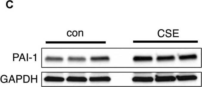 CSE decreases the fibrinolytic activity of LECs in vitro.(A) Immunocytochemical staining of cultured human microvascular lymphatic endothelial cells (LECs) for the human lymphatic markers, PROX1 and podoplanin (red). (B) Fibrin gel zymogram using supernatants from control or CSE-treated LECs. (C) Western blot for PAI-1 using cell lysates from control or CSE-treated LECs. GAPDH was used as a loading control on the same blot. (D,E) Expression of PAI-1 and t-PA by quantitative PCR using lysates from control or CSE-treated LECs and normalized to GAPDH. (F) Western blot using lysates from cells treated with CSE with and without co-incubation with N-acetylcysteine (NAC). GAPDH was used as a loading control on the same blot. Values are expressed as means ± SD. p-value calculated by Student’s t-test, **** p < 0.0001, ns = not significant. Data representative of two independent experiments performed in triplicate. Image collected and cropped by CiteAb from the following open publication (//pubmed.ncbi.nlm.nih.gov/38440076), licensed under a CC-BY license. Not internally tested by R&D Systems.