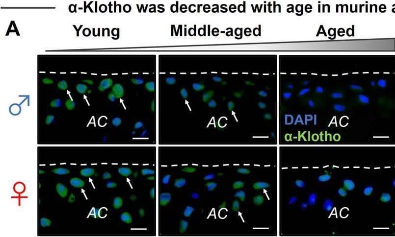 Age-related declines in  alpha -Klotho are associated with cartilage degeneration in male mice. A Aging induced a progressive decline of  alpha -Klotho in the murine medial tibia (n = 5/sex/age). White arrows indicate  alpha -Klotho-positive chondrocytes. White dashed lines indicate cartilage surface. AC articular cartilage. Scale bar: 10 μm.  alpha -Klotho expression per cell was quantified by immunofluorescence (50–100 cells per mouse). B Cartilage in older adults (≥65 years old; 71.9 ± 2.91 years; n = 7 [1 female]) displayed reduced  alpha -Klotho expression compared to young adults (<40 years old; 27.6 ± 6.85 years; n = 7 [2 females]). Scale bar: 20 μm.  alpha -Klotho expression per cell was quantified by immunofluorescence (30–70 cells per cartilage sample). C Loss-of function in Klotho (Klotho+/−) triggered murine cartilage degeneration in a sex-dependent manner (young, n = 7 for wild-type [3 females], n = 10 for Klotho+/− [5 females]; middle-aged, n = 10 for wild-type [5 females], n = 8 for Klotho+/− [5 females]). Black arrows indicate cartilage surface disruption. AC articular cartilage. Scale bar: 50 μm. Statistical analyses were performed using linear regression (A), two-way ANOVA (C), and a two-tailed Student t test (B). Age-sex interaction was not significant for   alpha -Klotho expression in mice (A, p = 0.468). Data are presented as means ± 95% confidence intervals. Source data are provided as a Source Data file. Image collected and cropped by CiteAb from the following open publication (//pubmed.ncbi.nlm.nih.gov/36627269), licensed under a CC-BY license. Not internally tested by R&D Systems.