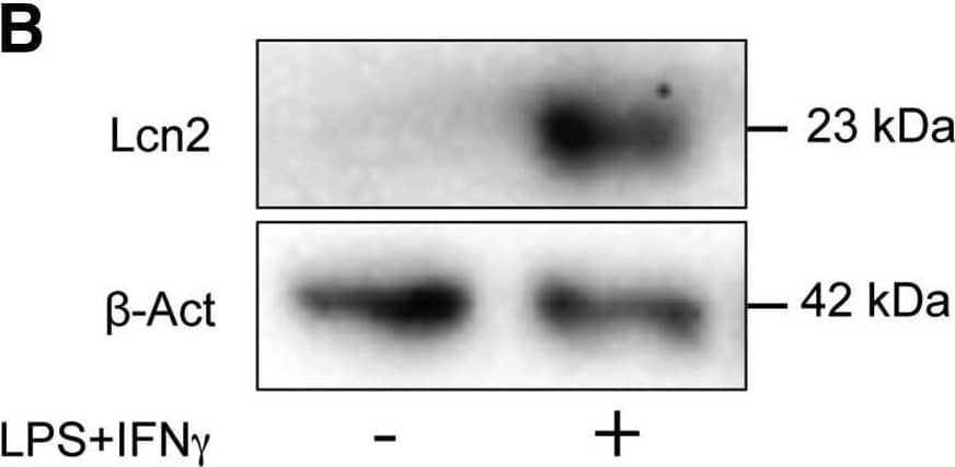 Response of Low-FBS/+FGF2 Cultured Astrocytes to LPS+IFN-gamma  Stimulation at the Protein Level(A) Representative western blot illustrating temporal induction of pSTAT3 upon 1 and 48 hr of treatment with LPS+IFN-gamma . (B and C) Representative western blots of activation markers in resting versus LPS+IFN-gamma -stimulated low-FBS astrocytes: (B) Lcn2 expression in resting and 24-hr-stimulated astrocytes; and (C) GFAP and Vim levels under resting conditions and following 48 hr of activation followed by 3 or 5 days of rest.  beta -Actin was used as a loading control. (D) Representative immunofluorescence micrographs of GFAP, Vim, and Lcn2 immunoreactivity in resting and activated conditions (GFAP/Vim: green; Lcn2: red; DAPI nuclear stain: blue). Scale bars, 100 μm. (E) Secreted IL-6 as measured by ELISA, resting versus activated conditions, at 48 and 120 hr post-stimulation. Data are expressed as the mean of n ≥ 3 biological replicates ± SD. *p ≤ 0.05, relative to non-activated control samples (multiple t tests with statistical significance determined using the Holm-Sidak method,  alpha  = 0.05). Image collected and cropped by CiteAb from the following open publication (//pubmed.ncbi.nlm.nih.gov/29499926), licensed under a CC-BY license. Not internally tested by R&D Systems.