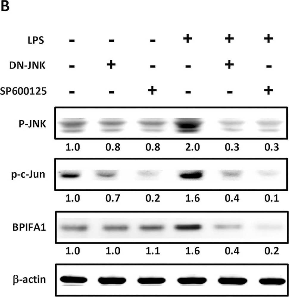 JNK/c-Jun pathway is involved in LPS-mediated up-regulation of BPIFA1 expression in nasal epithelial cells.(A) Cells were pretreated for 1 h with 20 μM PD98059 (ERK inhibitor), 10 μM SP600125 (JNK inhibitor), or 20 μM SB203580 (p38 inhibitor) and incubated with 10 μg/ml LPS for 2 h. (B) Cells were transfected with a JNK-dominant negative (DN-JNK) mutant for 24 h or pretreated with SP600125 for 30 min prior to incubation with LPS for 1 h. The protein expression levels were determined using western blot.  beta -actin was used as the loading control. The western blots were carried out independently in triplicate and results were representative of one of three independent experiments. The expression level of each protein was quantified by signal intensity and was indicated at the bottom of each lane. The quantitative analysis of western blot for three independent experiments was shown in S2 Fig. ANOVA with Tukey’s test was used to compare the overall difference between the groups. P < 0.05 was considered statistically significant. Image collected and cropped by CiteAb from the following open publication (//pubmed.ncbi.nlm.nih.gov/26646664), licensed under a CC-BY license. Not internally tested by R&D Systems.