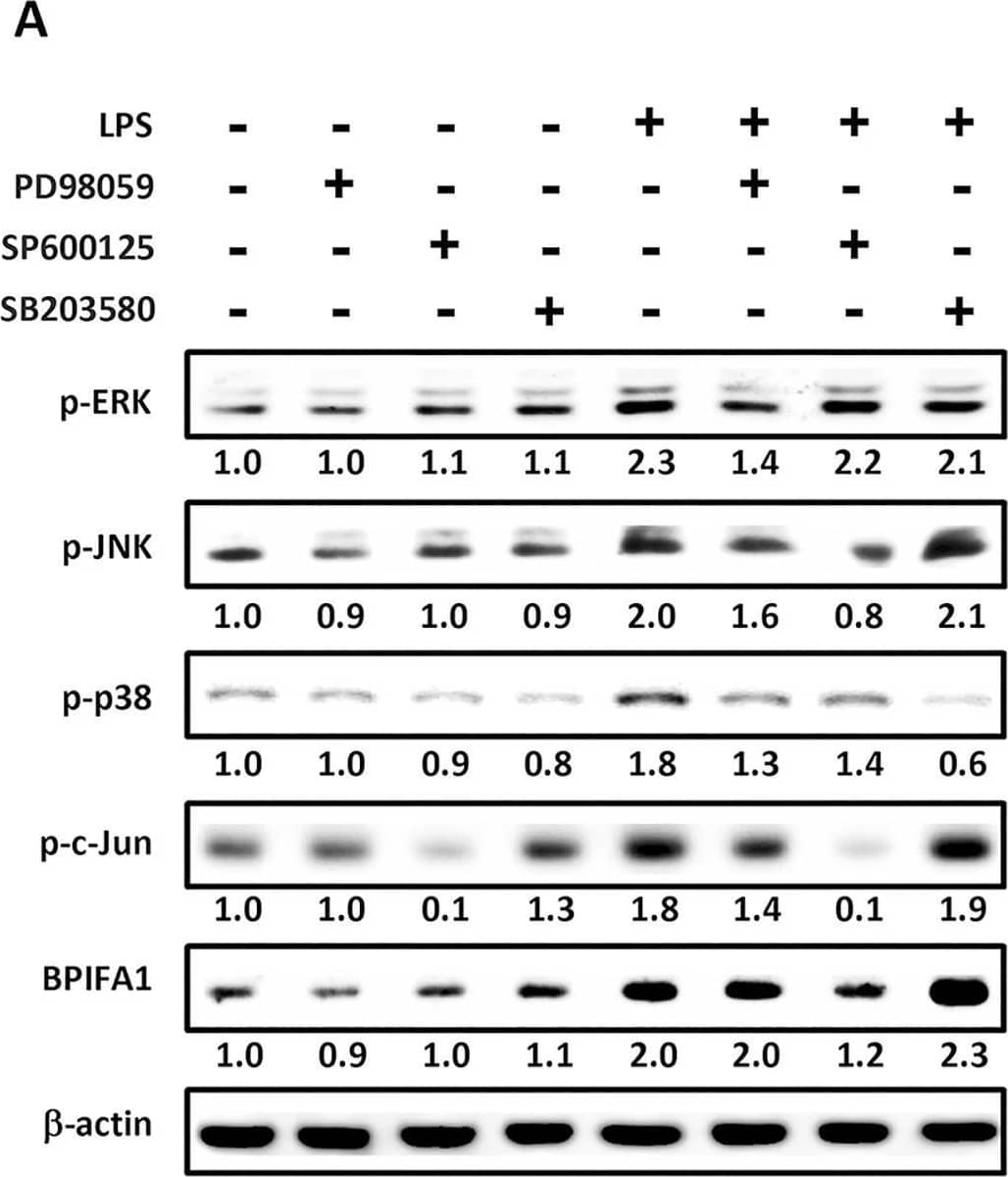 JNK/c-Jun pathway is involved in LPS-mediated up-regulation of BPIFA1 expression in nasal epithelial cells.(A) Cells were pretreated for 1 h with 20 μM PD98059 (ERK inhibitor), 10 μM SP600125 (JNK inhibitor), or 20 μM SB203580 (p38 inhibitor) and incubated with 10 μg/ml LPS for 2 h. (B) Cells were transfected with a JNK-dominant negative (DN-JNK) mutant for 24 h or pretreated with SP600125 for 30 min prior to incubation with LPS for 1 h. The protein expression levels were determined using western blot.  beta -actin was used as the loading control. The western blots were carried out independently in triplicate and results were representative of one of three independent experiments. The expression level of each protein was quantified by signal intensity and was indicated at the bottom of each lane. The quantitative analysis of western blot for three independent experiments was shown in S2 Fig. ANOVA with Tukey’s test was used to compare the overall difference between the groups. P < 0.05 was considered statistically significant. Image collected and cropped by CiteAb from the following open publication (//pubmed.ncbi.nlm.nih.gov/26646664), licensed under a CC-BY license. Not internally tested by R&D Systems.
