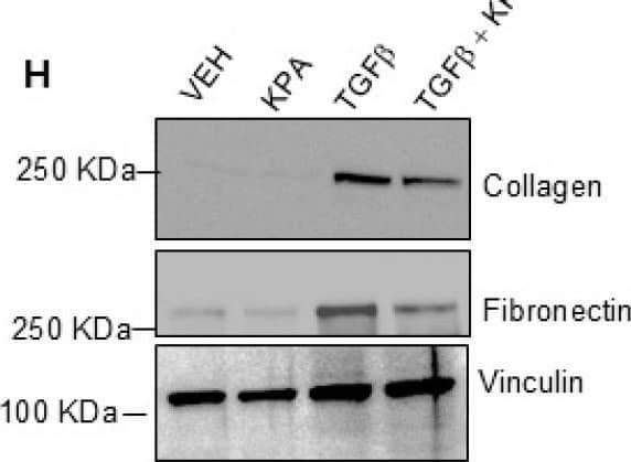 KPA treatment decreases activation of human hepatic stellate LX-2 cells. Representative Western blots showing expression of endogenous (A) KISS1 protein (n = 5 biological replicates) and (B) KISS1R protein expression (n = 4 biological replicates). MDA-MB-231, SKBR3, and KISS1R-SKBR3 were used as reference for expression (n = 4). (C) Secreted kisspeptin protein in culture media measured by ELISA (N-4 biological replicates). (D–G) Changes in fibrogenic gene expression in response to KPA (3 nM, 48 h) +/− TGFb (5 ng/mL, 48 h). (n = 4–6 biological replicates) (H) Western blot analysis and (I,J) densitometric analyses of blots, showing changes in fibrogenic protein in response to KPA (3 nM, 72 h) +/− TGFb (5 ng/mL, 72 h). (n = 4 biological replicates) Results are expressed as mean +/− S.E.M. * p < 0.05 vs. control. ** p < 0.01 vs. control. *** p < 0.001 vs. control. **** p < 0.0001 vs. control. One-way ANOVA was conducted, followed by multiple comparison test. Image collected and cropped by CiteAb from the following open publication (//pubmed.ncbi.nlm.nih.gov/39404414), licensed under a CC-BY license. Not internally tested by R&D Systems.