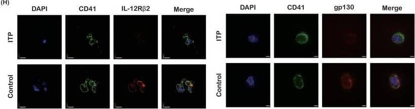 Reduced IL‐35 in patients with ITP. A) The level of plasma IL‐35 by ELISA (n = 12 in the control group, n = 26 in the ITP group). B) The concentration of IL‐35 in the bone marrow of ITP patients and healthy controls by ELISA (n = 22 in the control group, n = 10 in the ITP group). C) Expression of IL‐35 receptor subunit IL‐12R beta 2 in CD41/CD61+ cells by flow cytometry (n = 10). D) The mean fluorescence intensity of IL‐12R beta 2 on day 10 by flow cytometry (n = 10). E) Expression of IL‐35 receptor subunit gp130 in CD41/CD61+ cells by flow cytometry (n = 10). F) The mean fluorescence intensity of gp130 on day 10 by flow cytometry (n = 10). G) The protein levels of IL‐35 receptor subunits IL‐12R beta 2 and gp130 in CD41/CD61+ cells (n = 6). H) CD41 (green), IL‐12R beta 2/ gp130 (red), and DAPI (blue) staining of CD41/CD61+ cells (600×; bar: 20 µm). Data information: Data are presented as mean ± SEM. *p < 0.05, **p < 0.01, ***p < 0.001; ns, no significant difference, using Student‘s t‐test (A, B, D, F) or ANOVA (C, E). Image collected and cropped by CiteAb from the following open publication (//pubmed.ncbi.nlm.nih.gov/38225757), licensed under a CC-BY license. Not internally tested by R&D Systems.