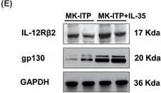 Western Blot IL-12 R beta 2 Antibody (622509)