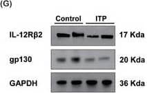 Western Blot IL-12 R beta 2 Antibody (622509)