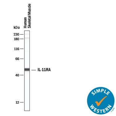 Simple Western lane view shows lysates of human skeletal muscle, loaded at 0.2 mg/mL. A specific band was detected for IL‑11 R alpha  at approximately 49 kDa (as indicated) using 50 µg/mL of Mouse Anti-Human IL‑11 R alpha  Monoclonal Antibody (Catalog # MAB19771) . This experiment was conducted under reducing conditions and using the 12-230 kDa separation system.