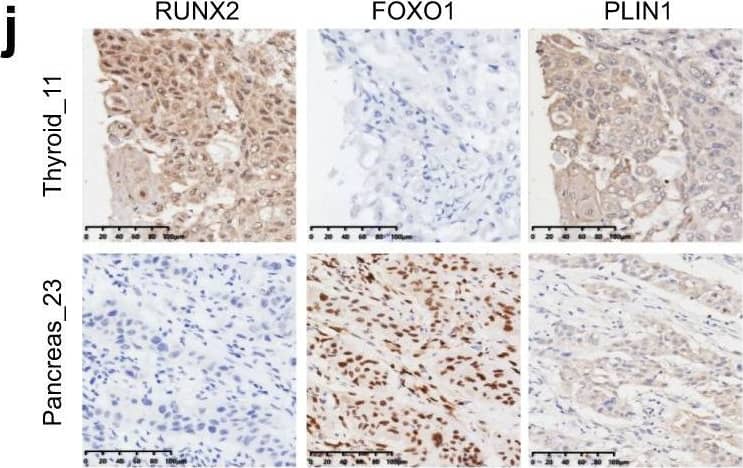 Immunohistochemistry RUNX2/CBFA1 Antibody (232902) [Unconjugated]