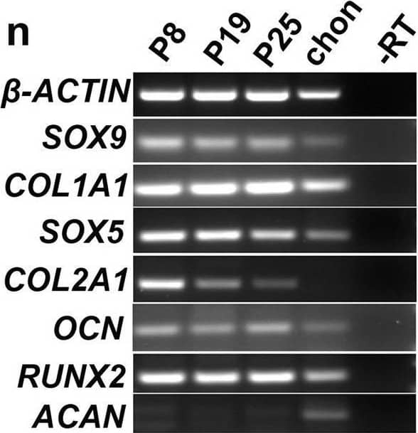 Western Blot RUNX2/CBFA1 Antibody (232902) [Unconjugated]