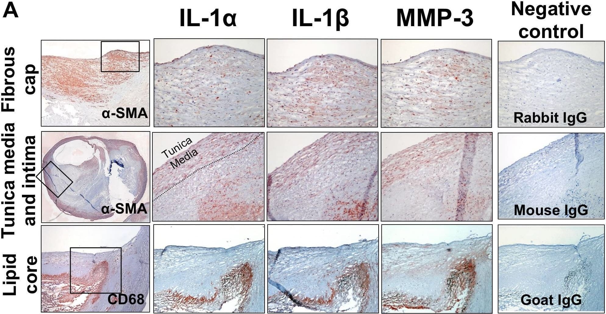 Immunohistochemistry IL-1 alpha/IL-1F1 Antibody (4414) [Unconjugated]
