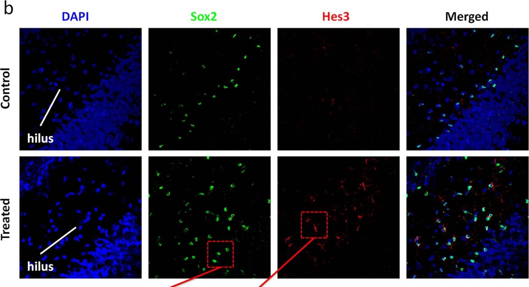Immunocytochemistry/ Immunofluorescence SOX2 Antibody (245610) [Unconjugated]