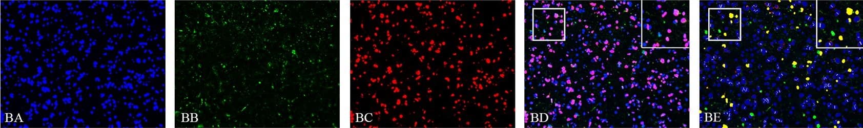 Immunocytochemistry/ Immunofluorescence SOX2 Antibody (245610) [Unconjugated]